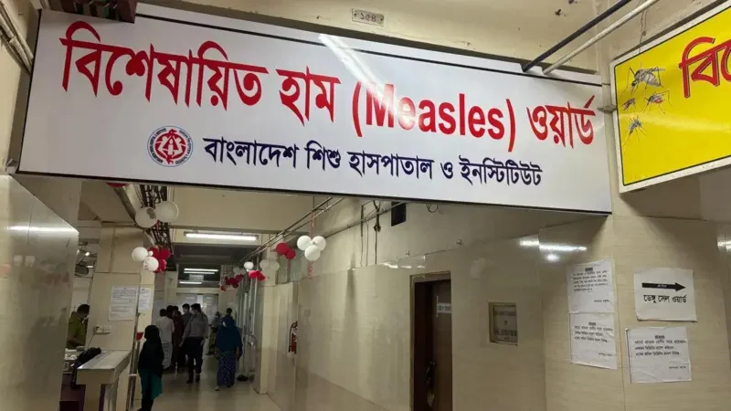 ১ দিনে হাম উপসর্গে আরও ১১ শিশুর মৃত্যু